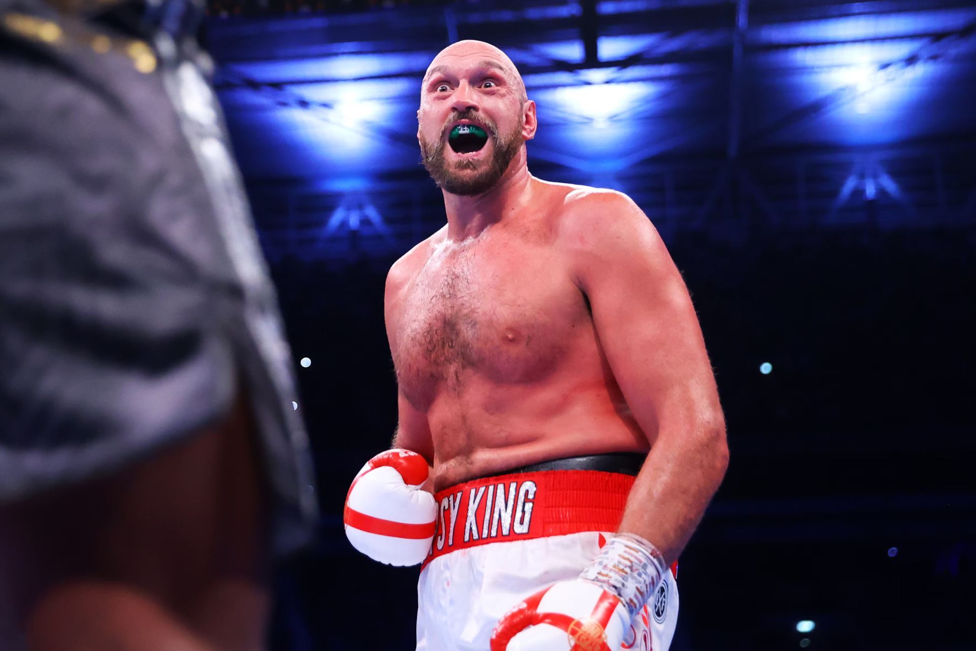 Tyson Fury.