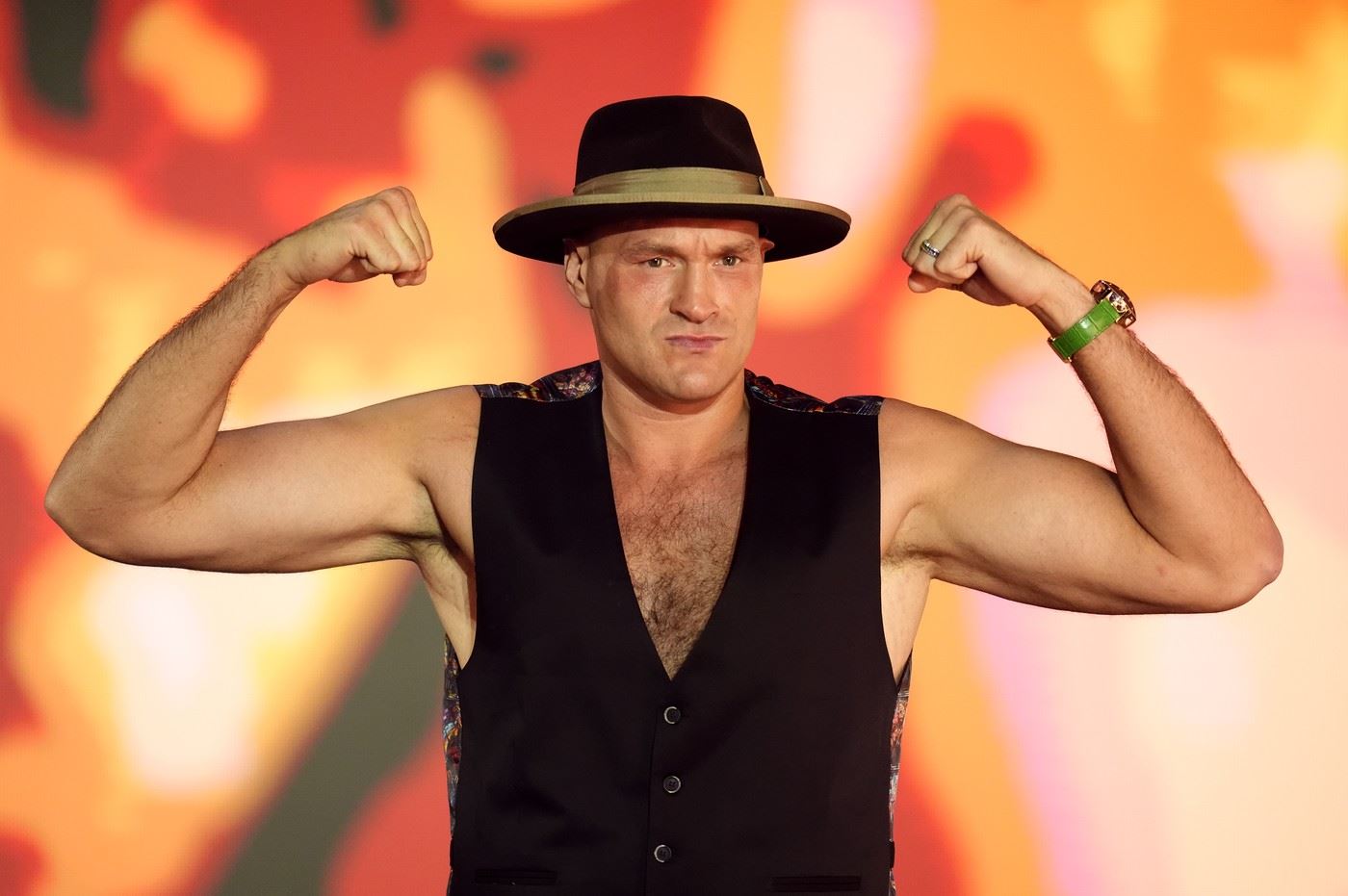 Tyson Fury.