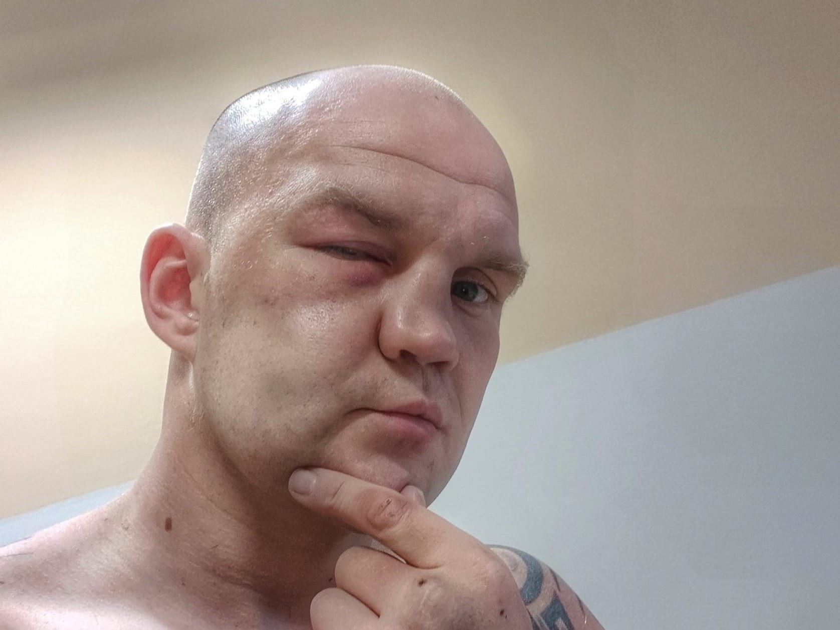Masakr, blbej nápad, půl huby pořád necítím, vzpomíná na premiéru v boxu bez rukavic Eschner