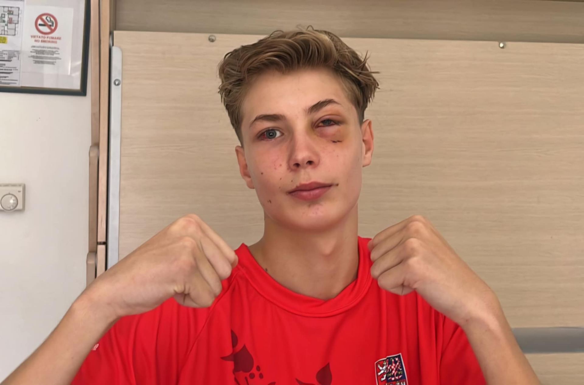 Vladyslav Kushnir a zranění na ME.