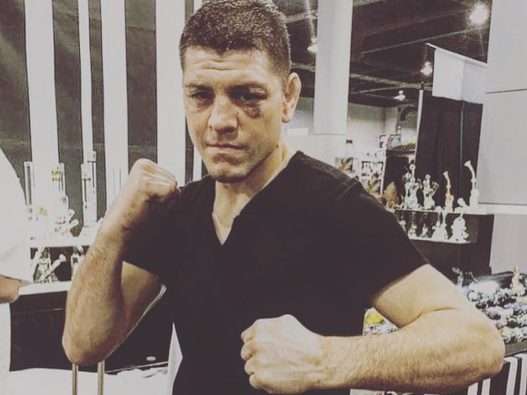 Fandit bratrovi už mu nestačí. Manažer prozradil, že Nick Diaz chystá senzační návrat