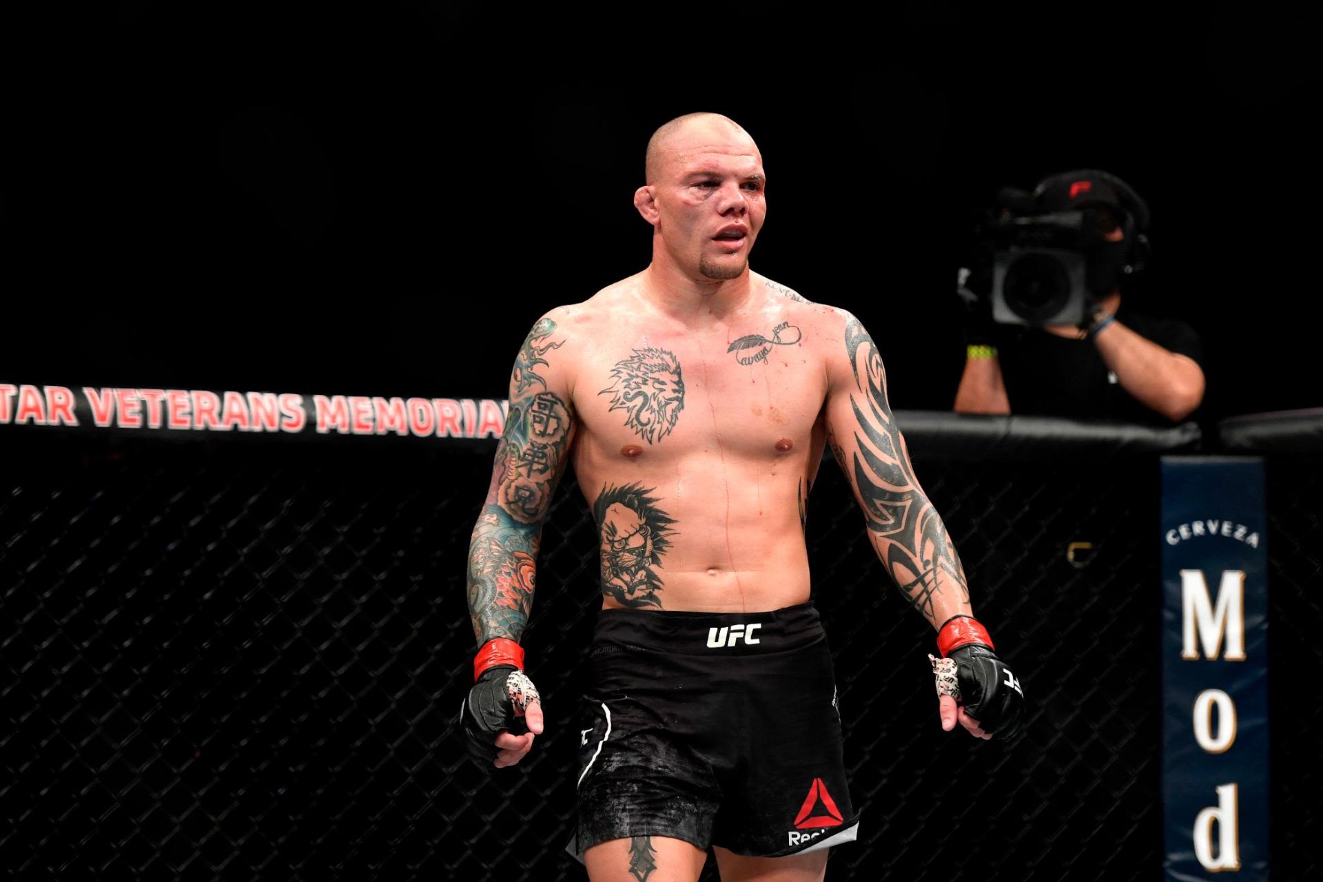 Anthony Smith.
