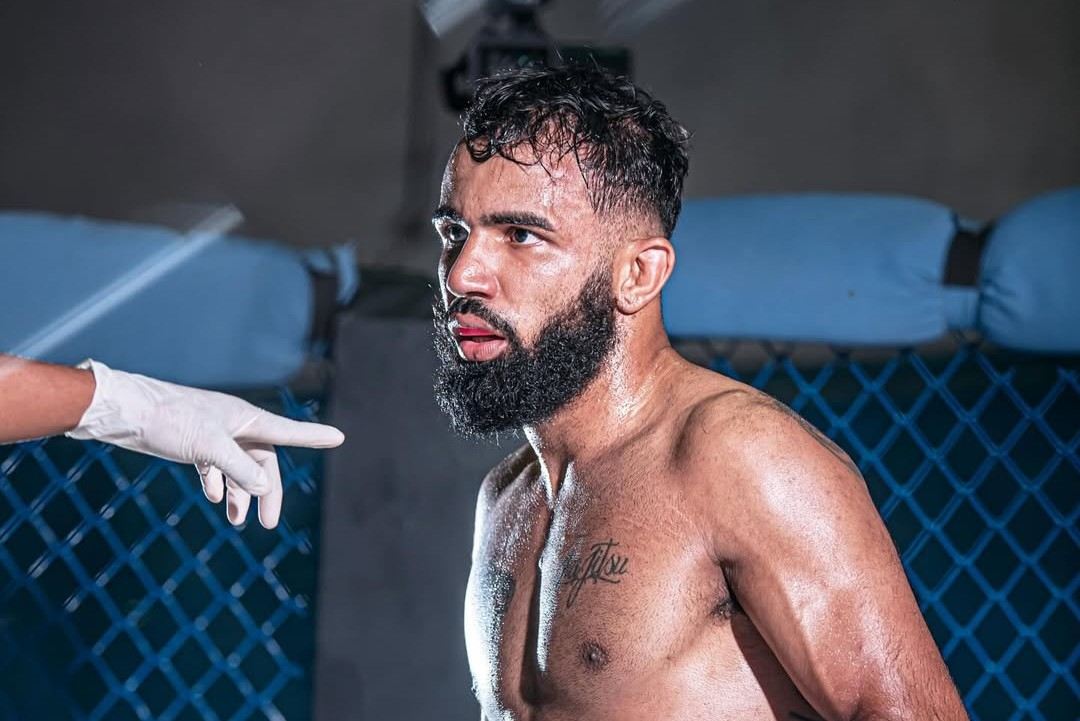 Igor Elizeu utrpěl nesmírně bolestivé zranění.