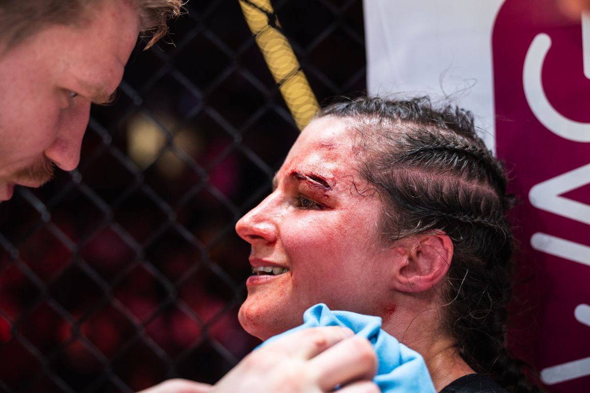 Boj, to jsou i tržné rány. Jde to i s úsměvem. 