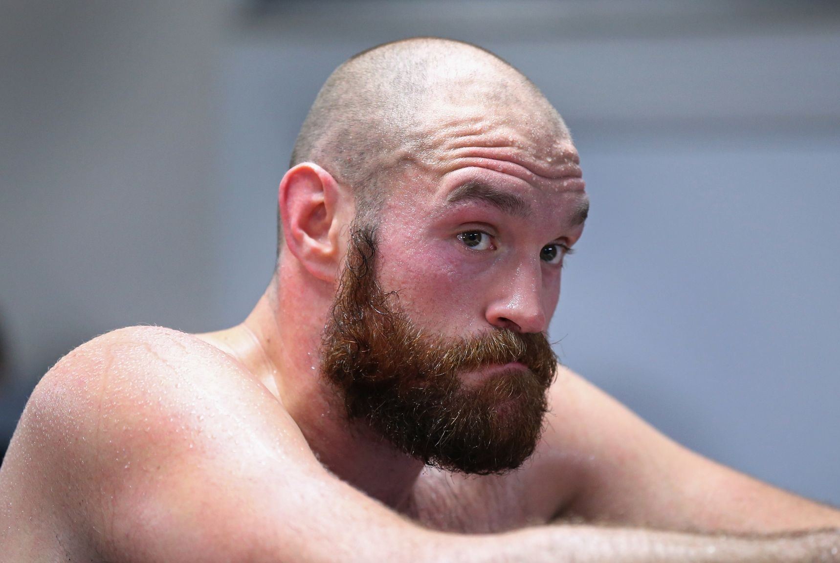 Tyson Fury. 