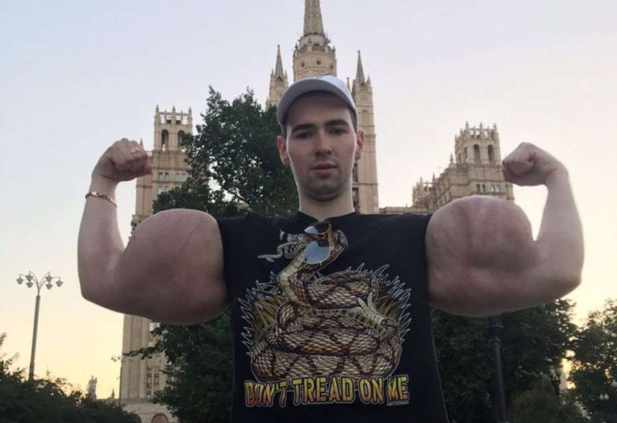 Hazard se životem. Ruský Pepek popírá amputaci rukou