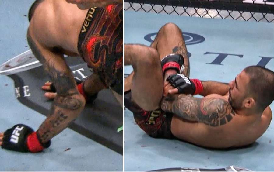 Z toho mrazí. Šampion UFC se nepříjemně zranil, po 26 sekundách přišel o pás