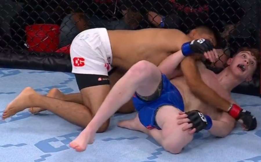 Jedno z nejhorších zranění v historii MMA. Američanovi trčela kost z kolena