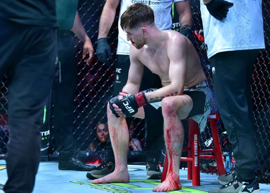 Krvavé tetování zastavilo bitvu v UFC. Otevřená holeň a zásah lékaře