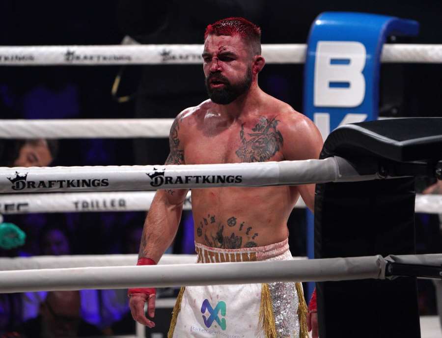 Odešli z UFC a rozdali si to v boxu bez rukavic. Boj rozhodla patrně zlomená čelist