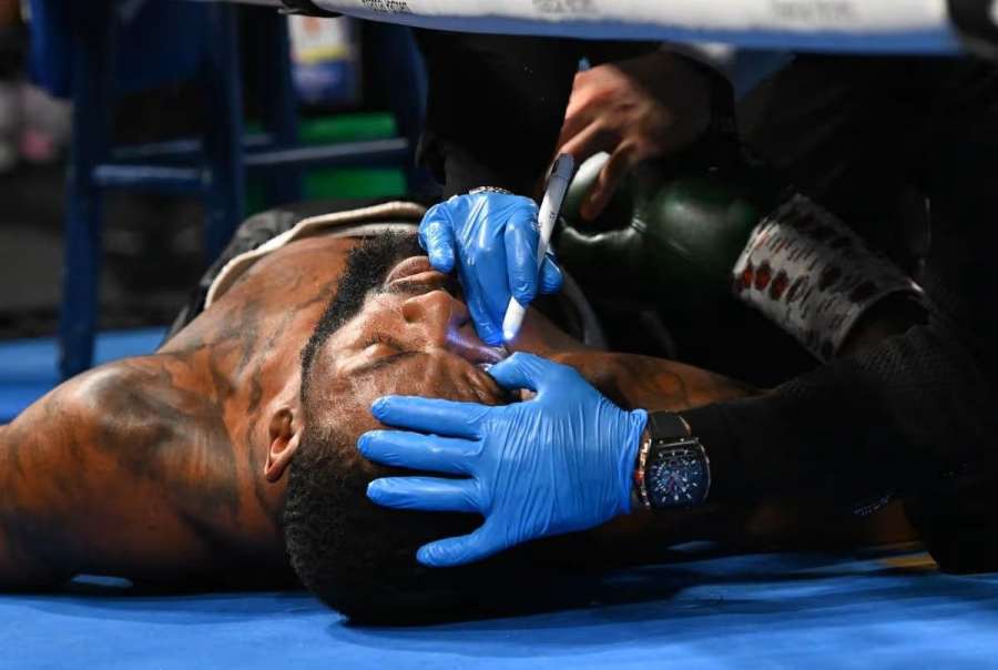 Moment, který všechny vyděsil. Boxer zkolaboval během přestávky