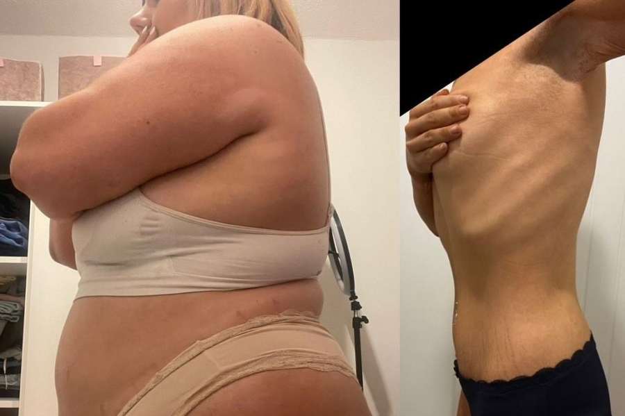 Byla moc velká. To pochopila, když se zasekla v lunaparku. Zhubla 70 kilo