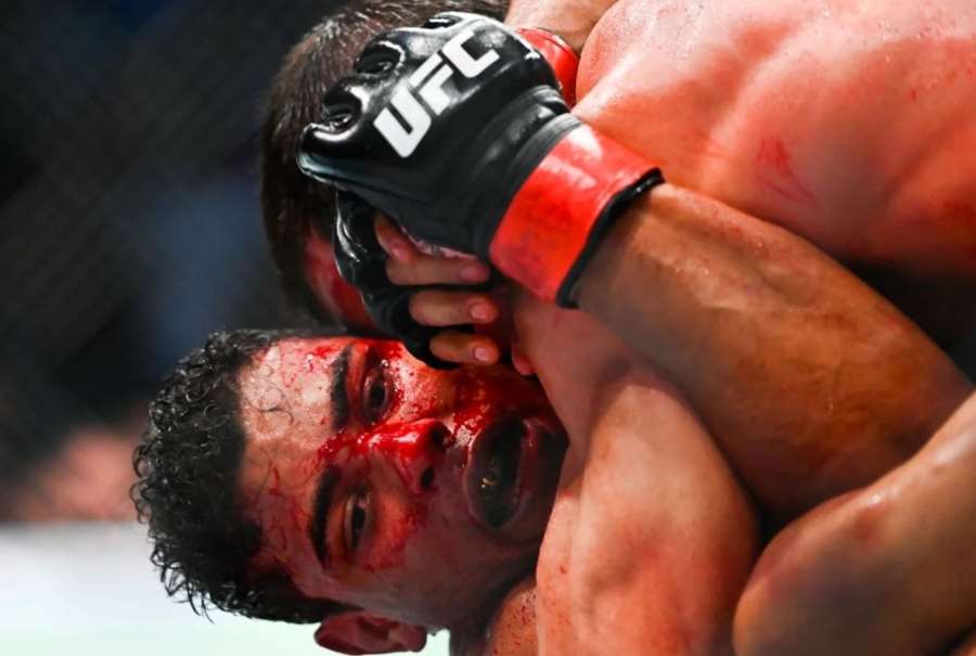 Nechutná scéna! Tohle si bývalý šampion UFC mohl odpustit