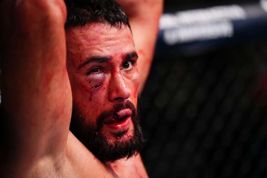 Těžká premiéra. Novic v UFC měl obličej na maděru