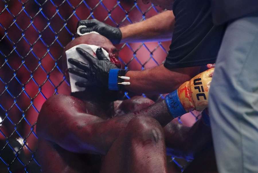 Obličej by byl pravděpodobně ještě více znetvořený, připustil UFC bojovník po bitvě