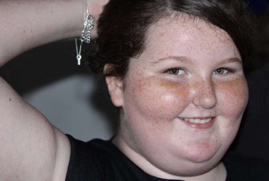 Vážila 138 kg. Dívka shodila přes 60 kilo, dnes nepoznává sama sebe