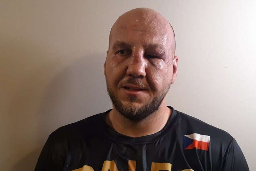 Česká supertěžká váha boxovala se zlomeným nosem a rukou. Daň za titulovou přestřelku
