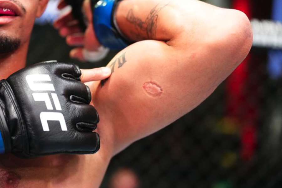 Zničený bojovník zažil týden hrůzy poté, co při debutu v UFC kousl soupeře