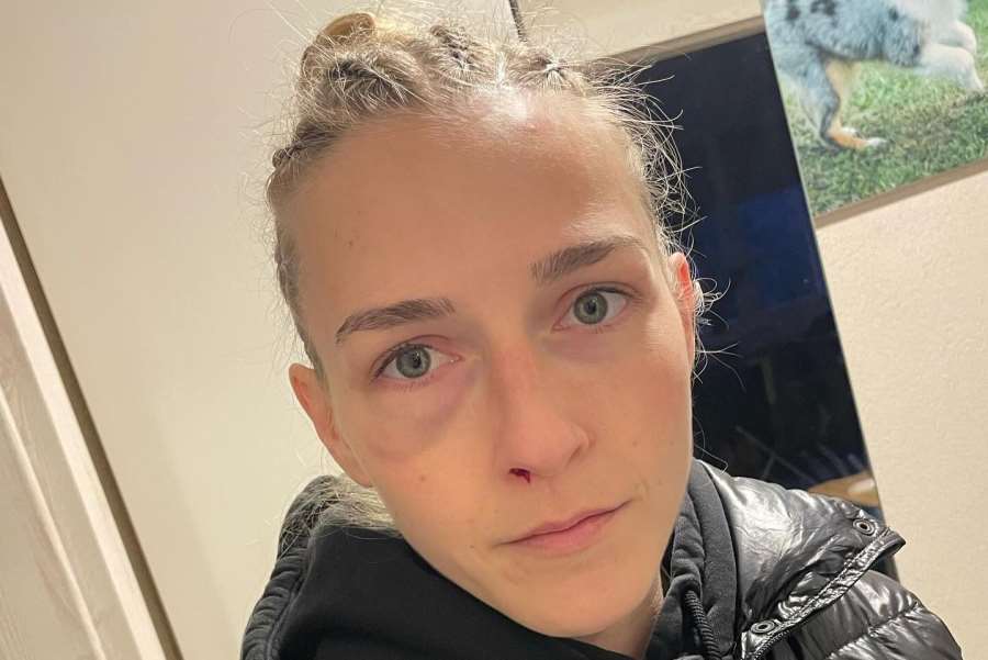 Česká boxerka musela dvakrát na operaci. Následek titulové bitvy v ringu